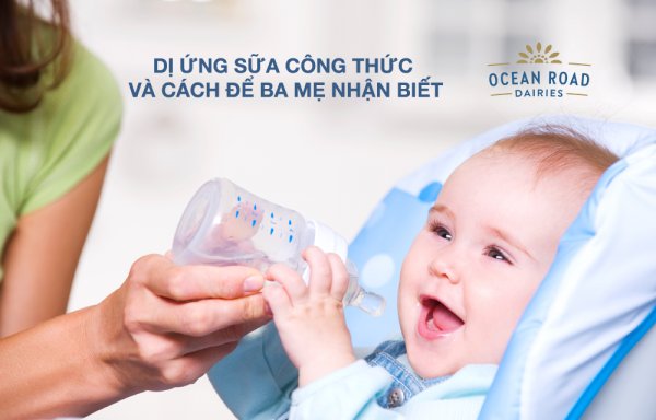 Dị ứng sữa công thức và cách để ba mẹ nhận biết