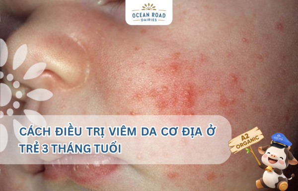 CÁCH ĐIỀU TRỊ VIÊM DA CƠ ĐỊA Ở TRẺ 3 THÁNG TUỔI