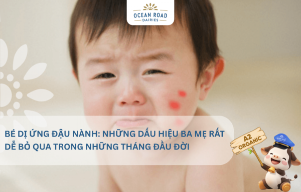 Bé dị ứng đậu nành: Những dấu hiệu mẹ rất dễ bỏ qua trong những tháng đầu đời